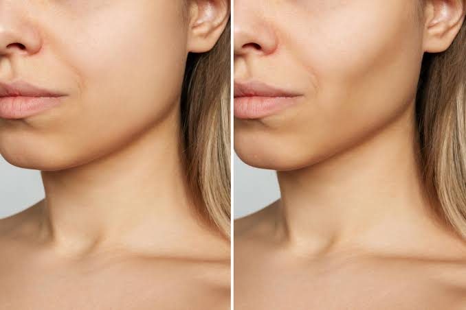 Procedimento cirúrgico facial e retirada de pele ganham destaque