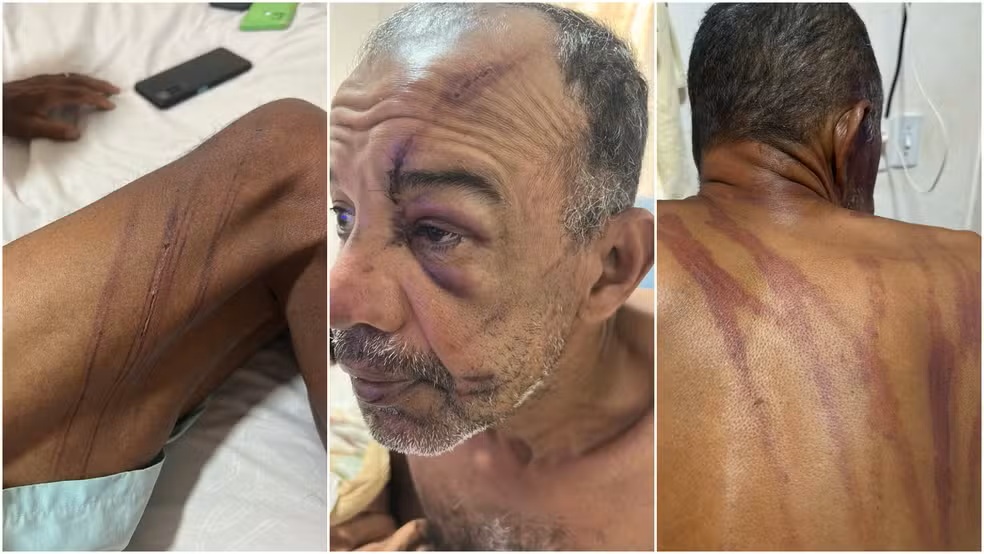 Homem denuncia espancamento por seguranças na Praia do Futuro, em Fortaleza