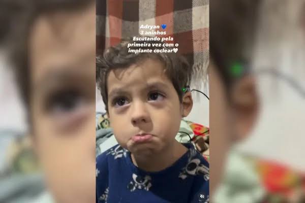 Menino brasileiro ouve pela primeira vez após tratamento raro para surdez