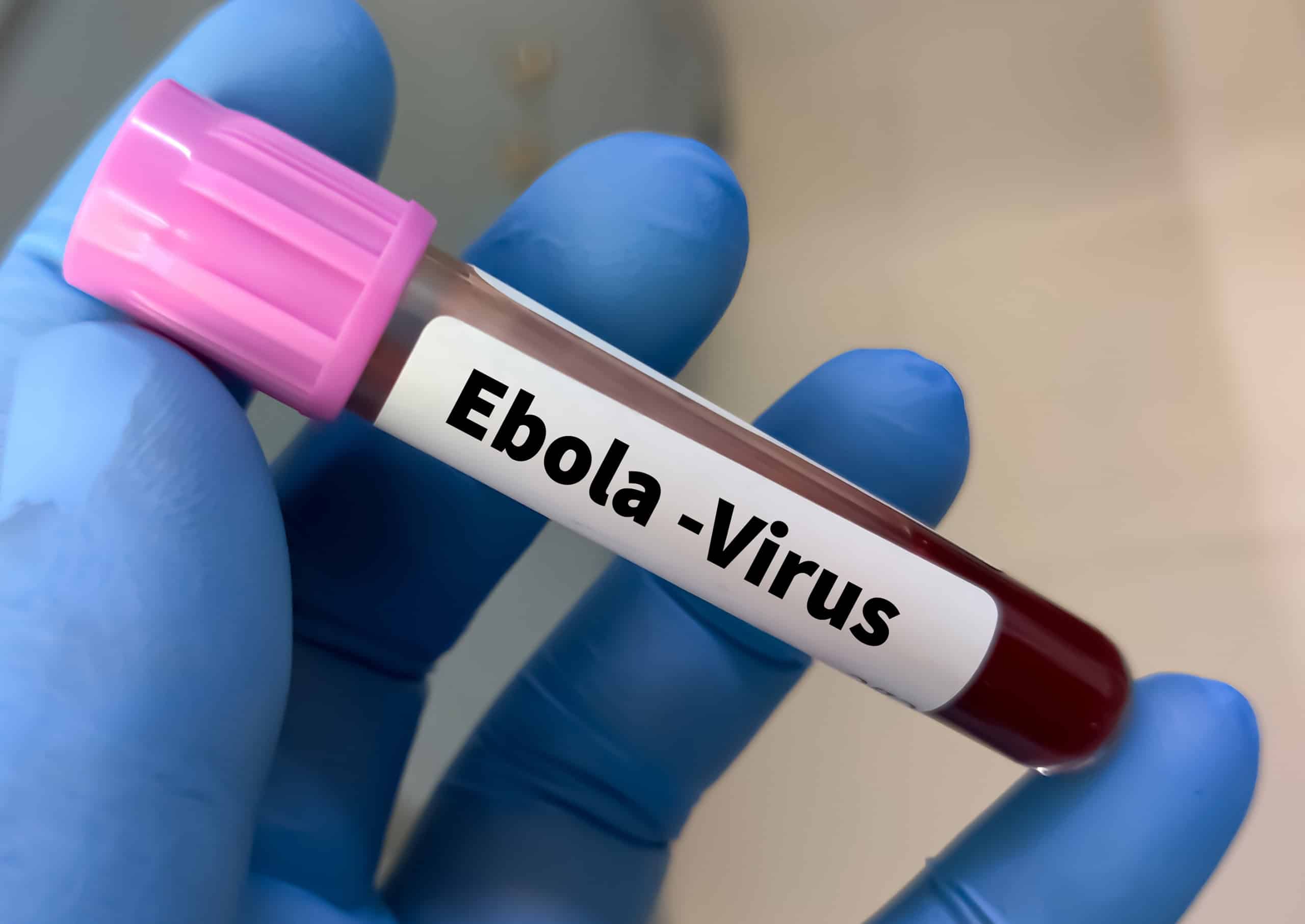 Nigéria confirma primeiro caso de Ebola e monitora dezenas de contatos