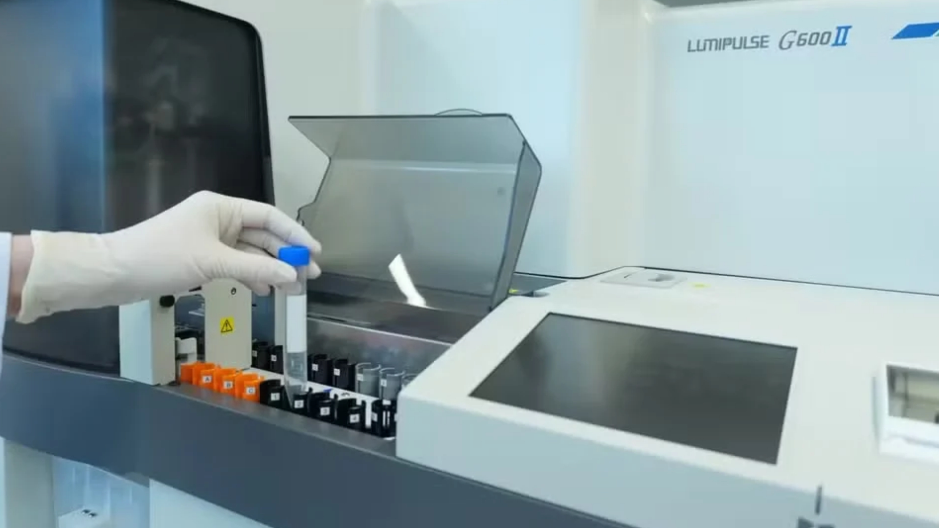 Primeiro exame de sangue para Alzheimer chega ao Brasil pela rede privada