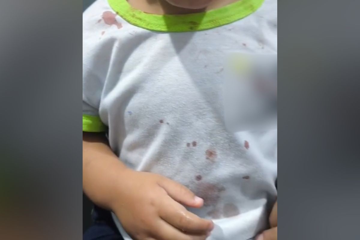 Polícia prende padrasto por maus-tratos e investiga caso como tortura no Paraná